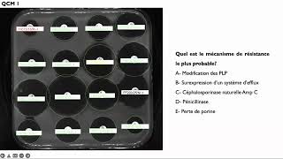 Lecture interprétative de l’antibiogramme de Pseudomonas aeruginosa [upl. by Grayson624]