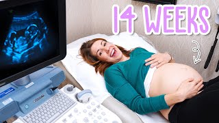 14 Week Pregnancy Ultrasound  Baby Moving and Yawning [upl. by Kohsa979]