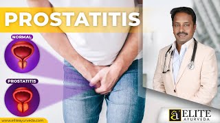 Prostatitis Treatment at EliteAyurveda  Treat Naturally with Herbal Ayurveda [upl. by Mohammad]