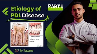 Etiology of PDL Disease  part 1 [upl. by Artima]