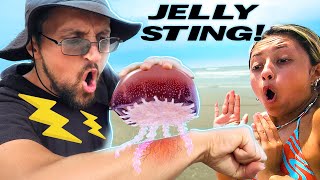 Stinging myself with Jellyfish to get Family Reactions PRANK [upl. by Arda]