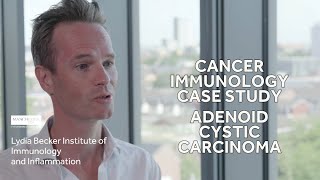 Adenoid Cystic Carcinoma  Cancer Immunology Case Study [upl. by Doomham]