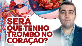 Trombo no coração como desfazer coágulos e qual risco de embolia AVC infarto e amputação na perna [upl. by Ynettirb]