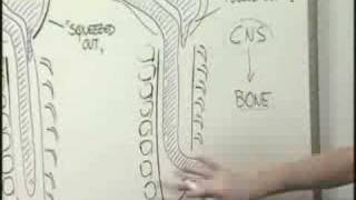 Chiari Malformation [upl. by Nilak]