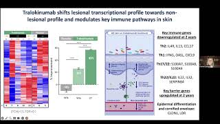 Dr GuttmanTargeing IL13 with tralokinumab normalizes type 2 inflammation in AD [upl. by Kristine986]