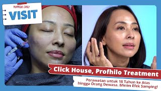 Treatment Profhilo Before dan After I MD Visit [upl. by Sass]