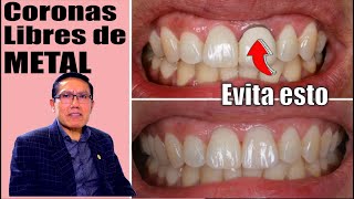 CORONAS dentales libres de METAL 🦷 PRÓTESIS más NATURALES 🦷 Dr YURI MARTINEZ 💋 Prodent Perú [upl. by Ise]