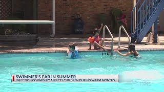 How to prevent and treat swimmers ear this summer [upl. by Stacee]