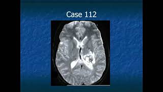 RADIOLOGY EXAM CASES [upl. by Merete]