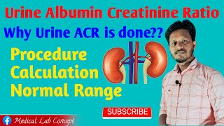 Urine ACR Principle amp Procedure with Calculation Labology [upl. by Tatiania]