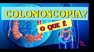 🌱COLONOSCOPIA  COMO É FEITO O EXAME E PARA QUE SERVE [upl. by Jonas737]