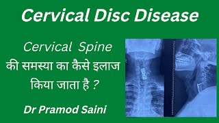 Cervical Spodylosis Cervical Myelopathy and Radiculopathy Diagnosis and Treatment [upl. by Essy]