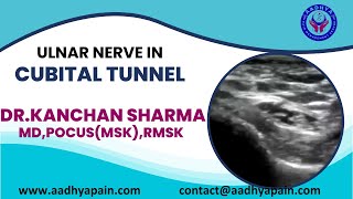 Ultrasound of the Ulnar Nerve in the Cubital Tunnel and its Dynamic Examination [upl. by Hairym]