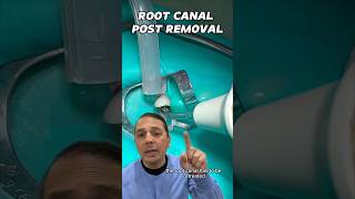 Could a Root Canal Be ReTreated  View Mobile Dental shorts [upl. by Lichter218]