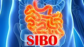 Small Intestinal Bacterial Overgrowth SIBO [upl. by Bourque]