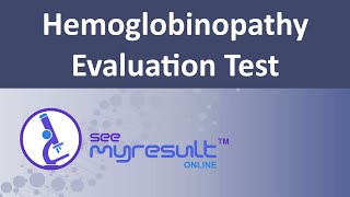 Hemoglobinopathy Evaluation Test [upl. by Allan]