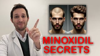 Minoxidil para recuperar tu pelo  secretos contados por médico [upl. by Enilrae727]