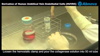 Derivation of Human Umbilical Vein Endothelial Cells HUVEC [upl. by Comptom]