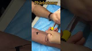 Laboratory tests  phlebotomy music viralshorts medicaleducation trending [upl. by Tatiania]