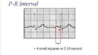 ECG PR Interval [upl. by Leod]