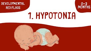 Low Muscle Tone Hypotonia in Babies  Episode 1 Developmental Red Flags 03 Months [upl. by Nylzaj]