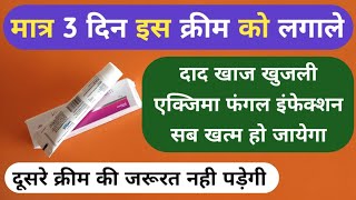 मात्र 1 क्रीम से दाद खाज खुजली 3 दिन में खत्म Best Ketoconazole Cream For Fungal Infection Problems [upl. by Drugi]