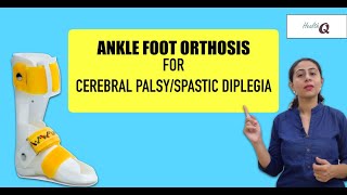 Things you should know about ANKLE FOOT ORTHOSIS [upl. by Ihteerp]