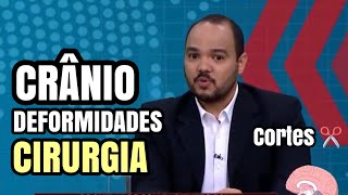 Deformidade no crânio do bebê como identificar e formas de tratamento para CABEÇA TORTA cortes [upl. by Gow]