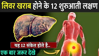 लिवर खराब होने में 12 शुरुआती लक्षण  12 Weird Signs Of Liver Damage  Liver Damage Signs In Hindi [upl. by Woody]