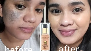 vlog 5 Covering my birthmark with Max Factor X foundationyeey or naay Goldie Lagera [upl. by Vacuva]