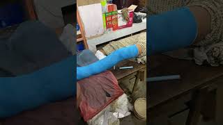 Fiber plaster  full video AR Medical Gyan is live [upl. by Ardnikat]