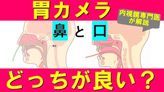 【胃カメラ】鼻からと口から、どちらがオススメ？内視鏡専門医が解説。 [upl. by Nolyat]