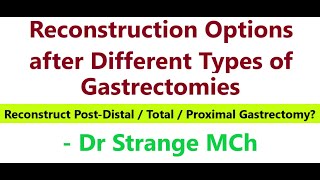 Reconstruction Options Post Various Types of Gastrectomies Part 1 HD GastrectomyReconstruction [upl. by Cherlyn]