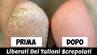 Come Allacciarsi Le Scarpe In 1 Secondo TUTORIAL HD [upl. by Wehrle953]