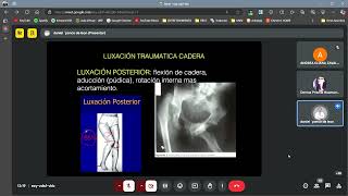 Semiología MIEMBRO INFERIOR  cadera rodilla tobillo meniscos ligamento cruzado  TRAUMATOLOGÍA [upl. by Leumel]