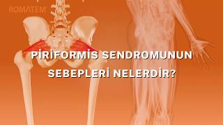 Piriformis Sendromu Romatem  Spor Yaralanmaları Bel Ağrısı Bacak Ağrısı Kalça Ağrısı Bel Fıtığı [upl. by Yvehc778]