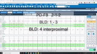 DentiAI Voice  Denticon Demo [upl. by Adnawad586]