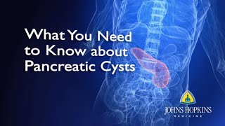 What You Need to Know About Pancreatic Cysts [upl. by Alyn355]