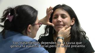 Parálisis Facial [upl. by Seidule]