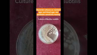 Bacillus subtilis Enterococcus fecalis Desulfovibrio cultures and colonies health microbiology [upl. by Dielu]