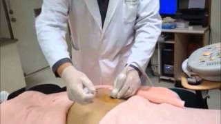 UltrasoundGuided Sacroiliac Joint Injection Technique [upl. by Akerehs396]