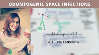 space infection in mandible I oral surgery lecture [upl. by Nylsaj]