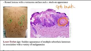 USMLE ACE Video 192 Skin Disorders Overview [upl. by Nadiya529]