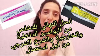 الوصفة المعجزة لعلاج البواسير و الشرخ الشرجي من اول استعمال [upl. by Bendicta]