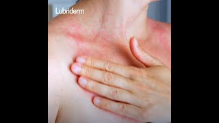 NUEVA Lubriderm® Clinical Therapy una revolución dermatológica [upl. by Brendin]