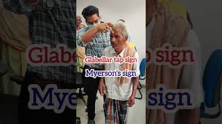 glabellar tap sign in Parkinsons Disease  Myersons sign  Glabellar Reflex mbbs neet [upl. by Naldo]