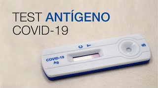 Test Antígeno COVID19 Clínica CEMTRO [upl. by Sivat]