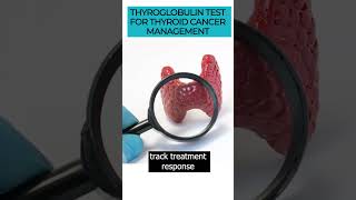 Discover the Thyroglobulin test amp its role in thyroid cancer detection and management thyroidcancer [upl. by Enrobso607]