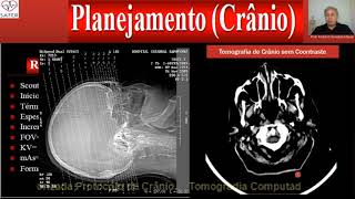 Tomografia Protocolo de Cranio Mix video 2018 [upl. by Suilienroc]