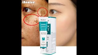 Whitening Freckle Cream Remove Melasma Dark Spot – iBeaLee™ [upl. by Chilton]